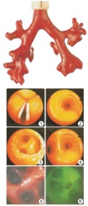 “康為醫(yī)療”CLA9/8熒光氣管支氣管樹(shù)模型(消化內(nèi)科技能模型）