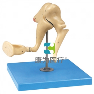 “康為醫(yī)療”聽小骨放大模型