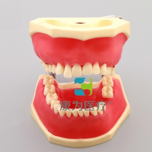 “康為醫(yī)療”牙周病模型