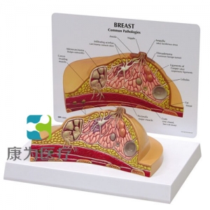 “康為醫(yī)療”醫(yī)患關(guān)系溝通模型-乳房橫斷切面模型 （醫(yī)學指導模型）