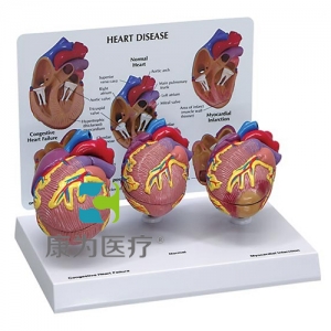 “康為醫(yī)療”醫(yī)患關系溝通模型-正常心臟解剖模型 （醫(yī)學指導模型）